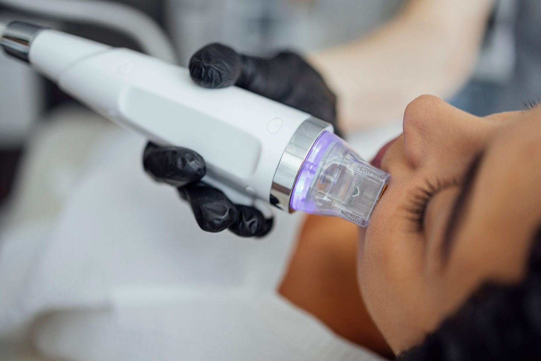 Professional Microneedling Machine for Face & Hair